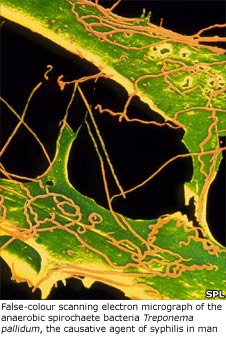 False-colour scanning electron micrograph of the anaerobic spirochaete bacteria Treponema pallidum, the causative agent of syphilis in man