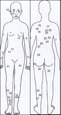 अनाथ लड़की की पिटाई के घाव