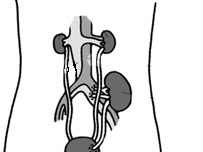 انسانی گردہ