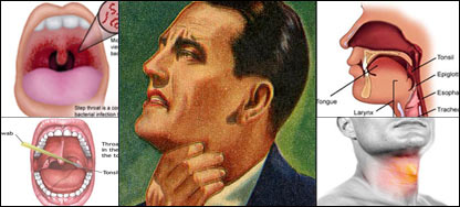 د ستوني درد