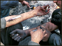 زرق هيروئين