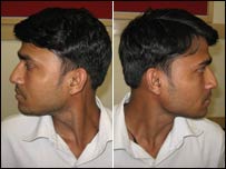 ग्रीवा संचालन