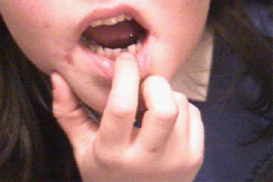 Flo loses her first milk tooth