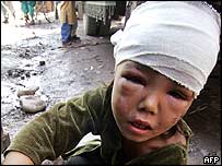 در اثر اين زلزله، تعداد زيادی کودک به ويژه در مدارس کشته شدند