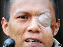 O ex-guerrilheiro Wilson Bueno Largo (MAURICIO DUENAS/AFP/Getty Images