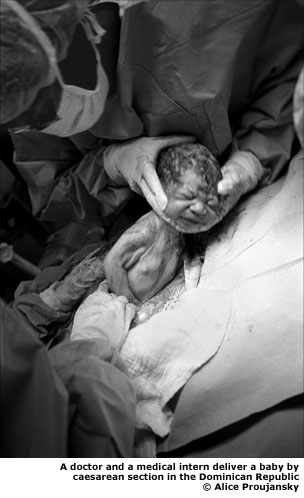 A doctor and a medical intern deliver a baby by Caesarean section in the Dominican Republic. © Alice Proujansky
