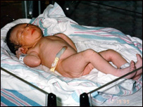 دماشوم دنوم پرې کول