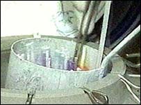 Ainda não está claro se óvulo foi ou não do ovário transplantado