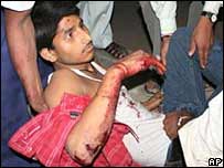 بنارس دھماکے میں زخمی ہونے والے ایک شخص کو لے جایا جا رہا ہے