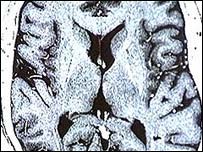 انسانی دماغ